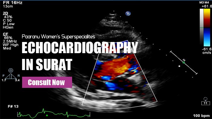 Echocardiography in Surat
