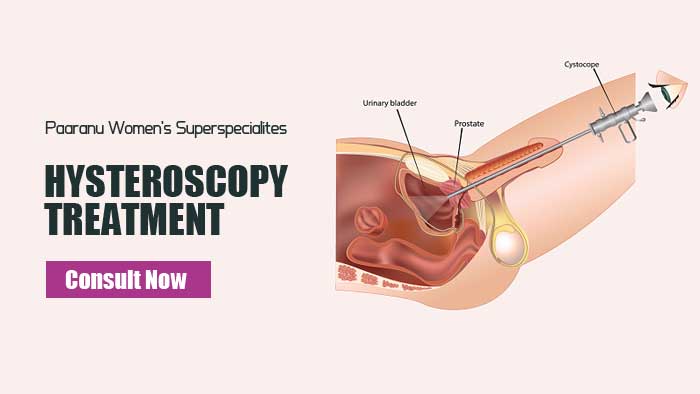 Hysteroscopy Treatment in Surat